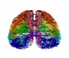 Dos nuevos mapas amplían el atlas del funcionamiento del cerebro