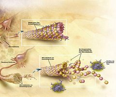 El alzhéimer podría estar relacionado con infecciones por hongos