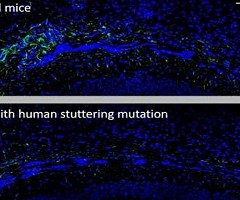 Un estudio en ratones identifica el tipo de célula cerebral involucrada en la tartamudez